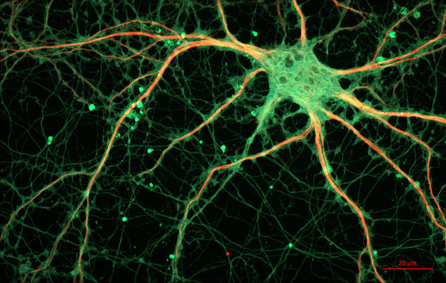 Image of a rat neuron courtesy of ZEISS Microscopy